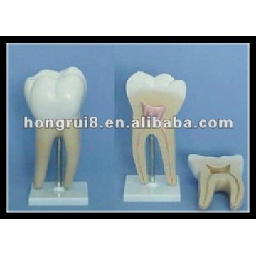 ISO Amplified Molar Model, Dental Molar Teeth Model HR/B10005-1